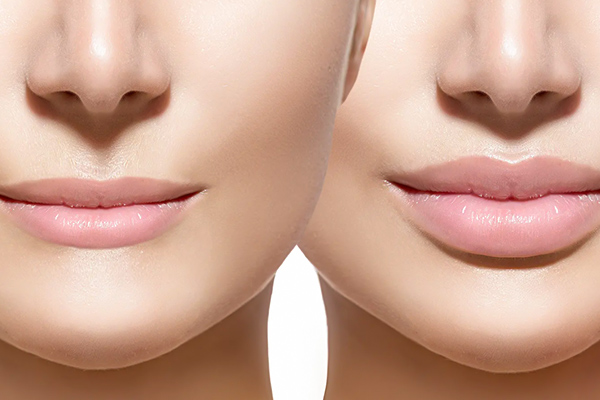 کوچک کردن لب ها